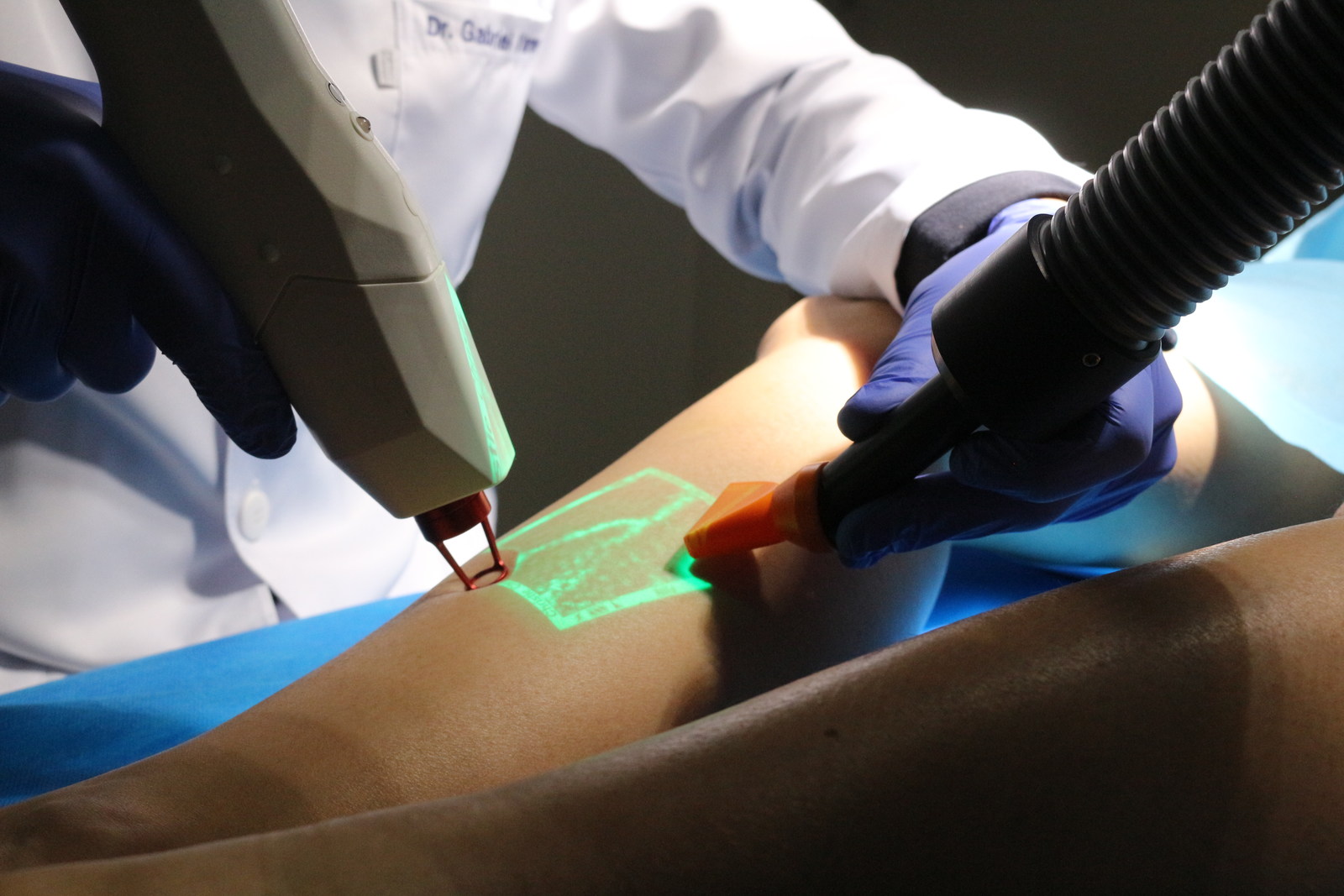 Laser transdérmico e Laser endovenoso: entenda quando cada um é ...
